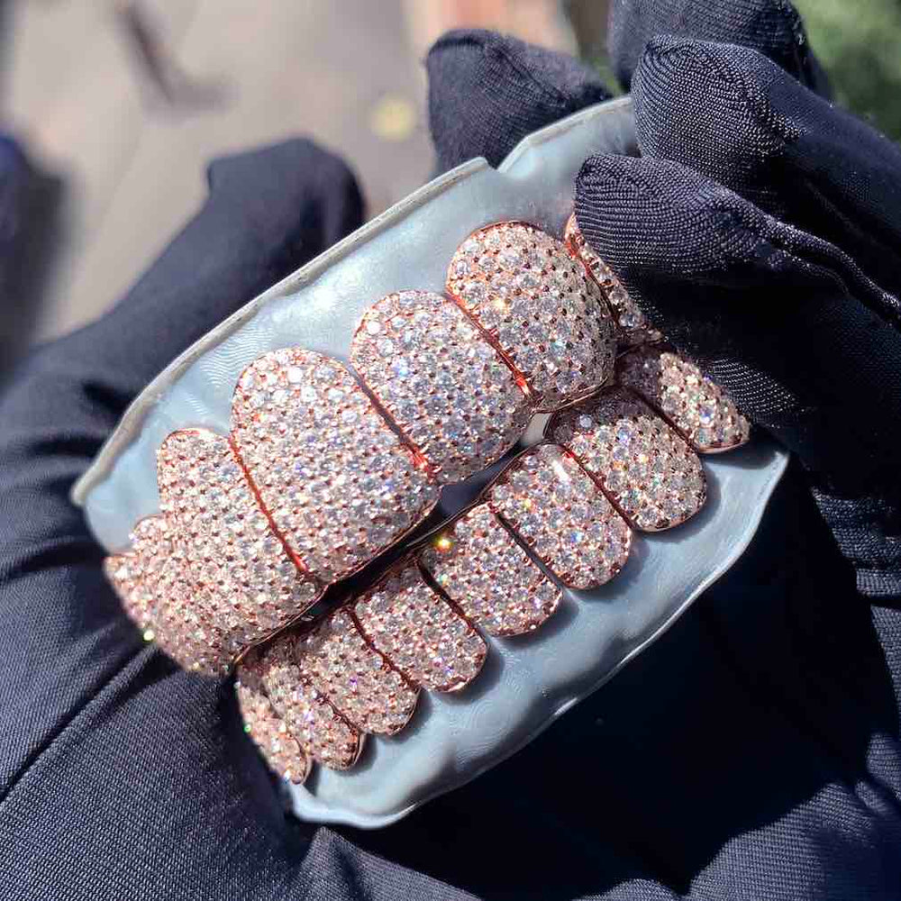 Rose Gold Perm Cut Custom Diamond Grillz outside