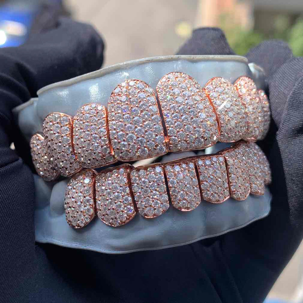 Rose Gold Perm Cut Custom Diamond Grillz front outside