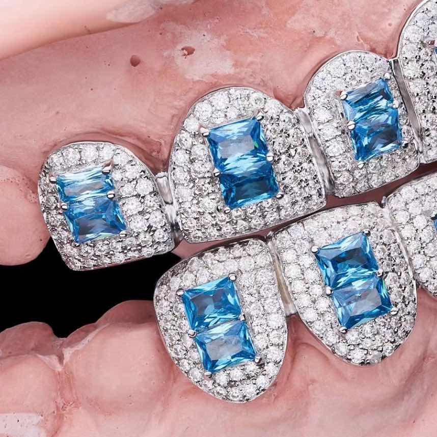 blue gemstone moissanite grillz closeup