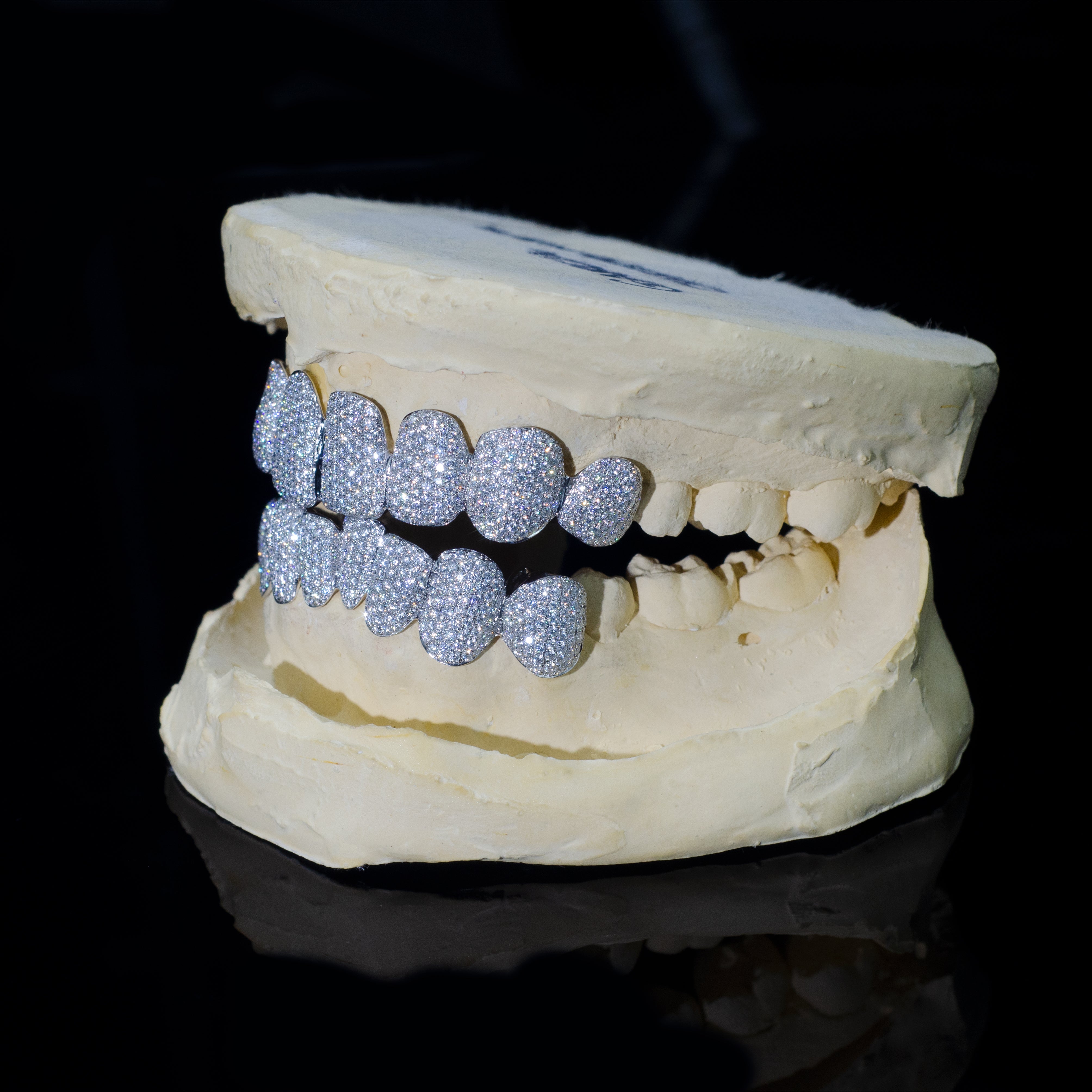 Custom Moissanite Grillz Side