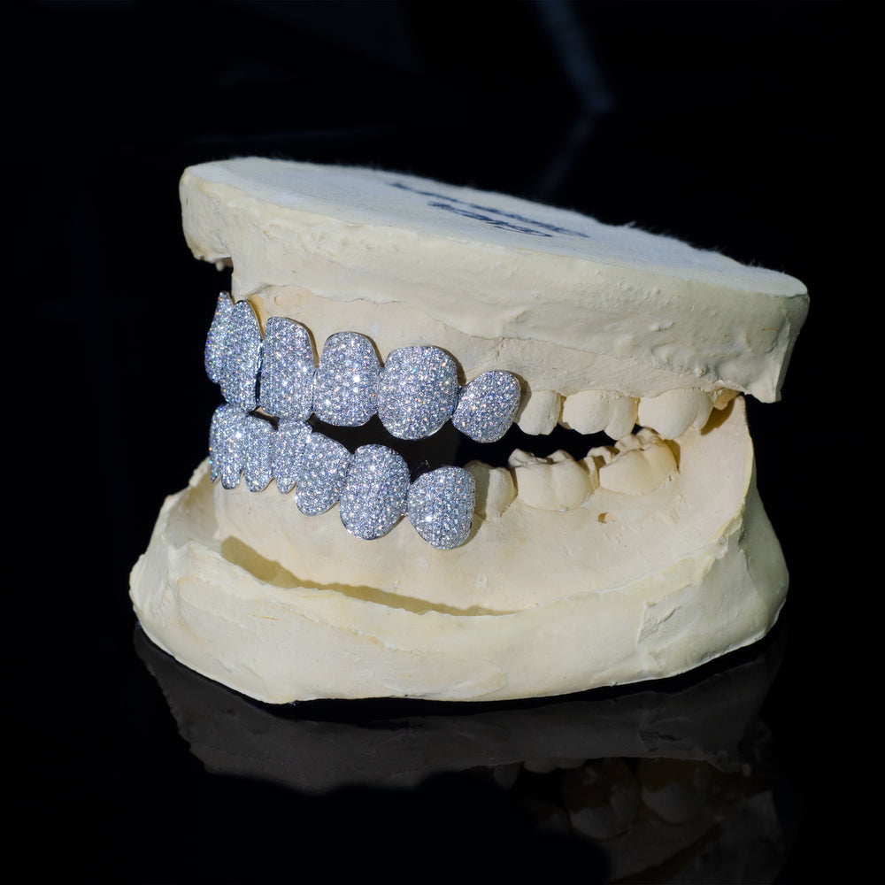 Custom Moissanite Grillz Side