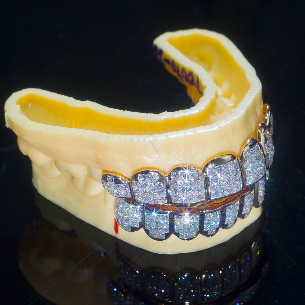 moissanite baguette diamond grillz side