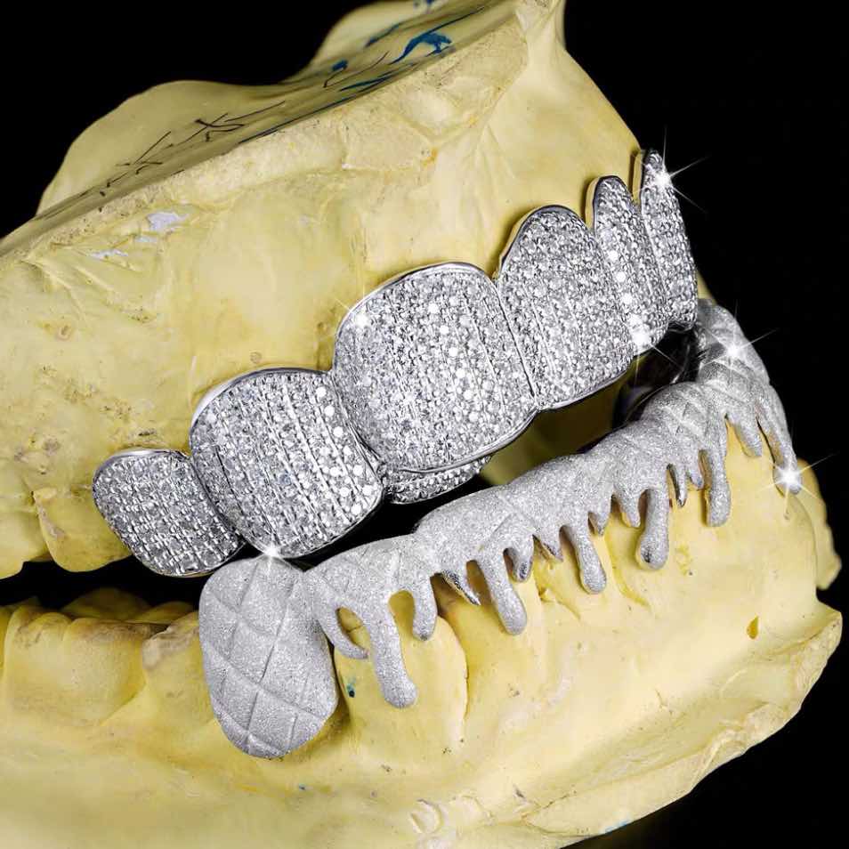 moissanite drippy grillz side 2