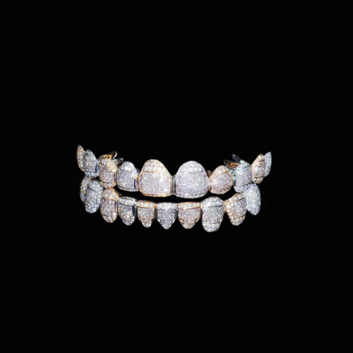 10 on 10 custom moissanite grillz icecartel main 1
