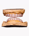 10 on 10 VVS Moissanite Prong Diamond Grillz - Rose Gold