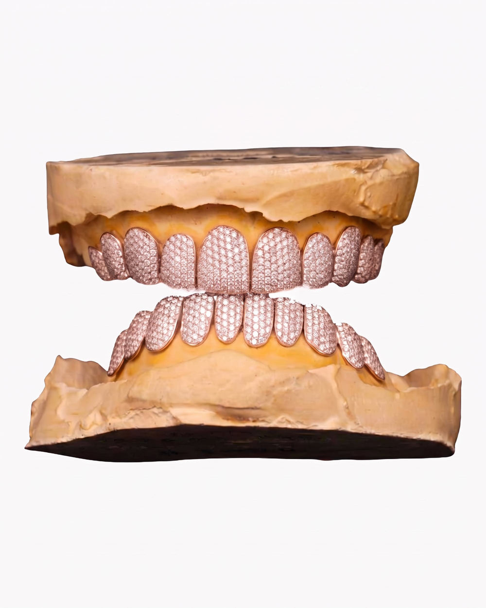 10 on 10 VVS Moissanite Prong Diamond Grillz - Rose Gold