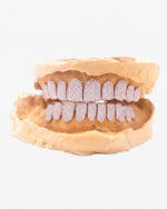 10 on 10 VVS Moissanite Prong Diamond Grillz - Rose Gold