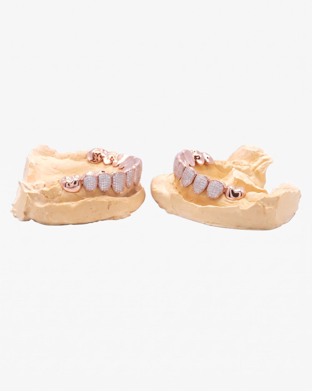 10 on 10 VVS Moissanite Prong Diamond Grillz - Rose Gold