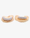 10 on 10 VVS Moissanite Prong Diamond Grillz - White Gold