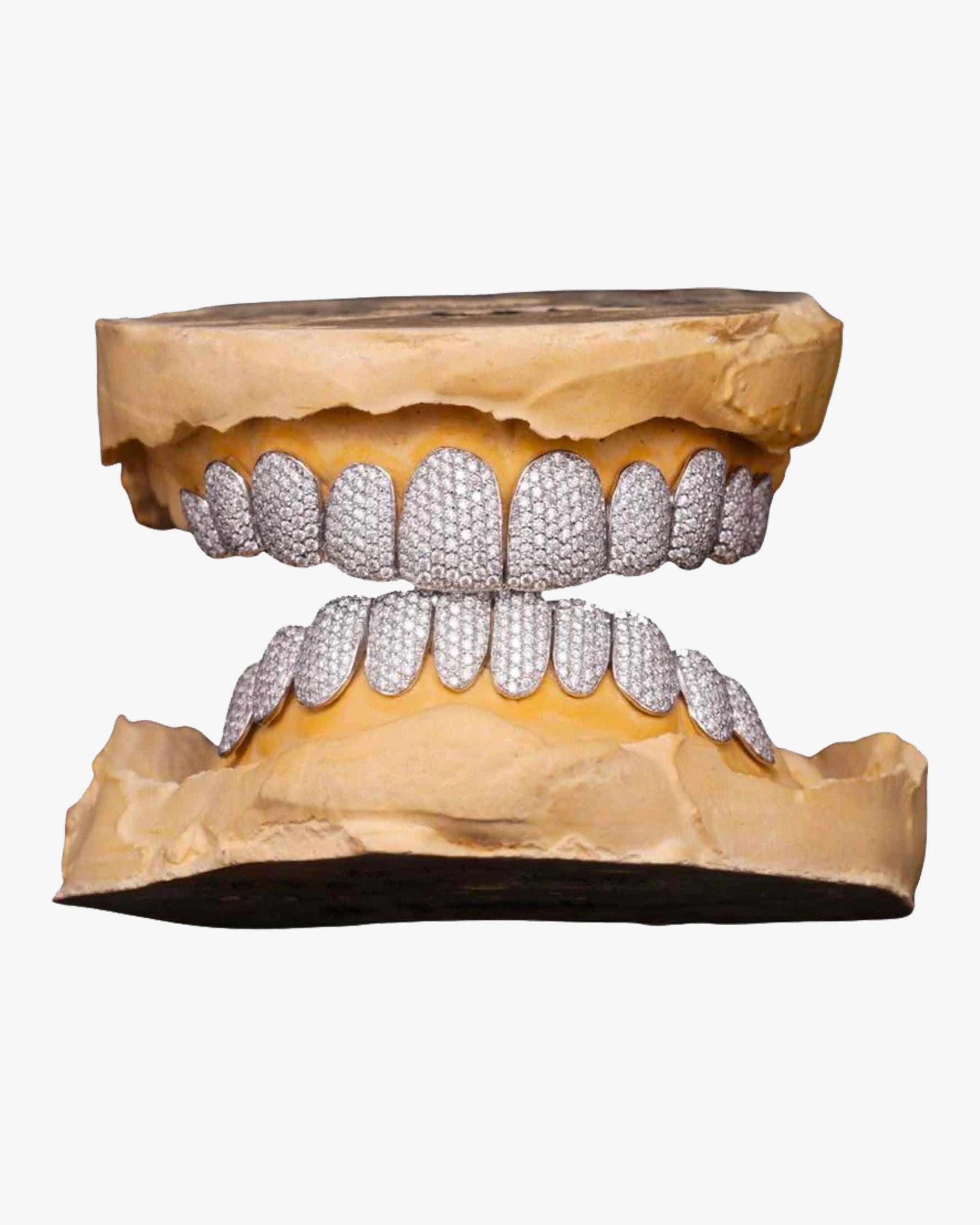 10 on 10 VVS Moissanite Prong Diamond Grillz