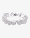 10 on 10 VVS Moissanite Prong Diamond Grillz - White Gold