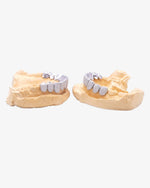 10 on 10 VVS Moissanite Prong Diamond Grillz - White Gold