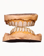 10 on 10 VVS Moissanite Prong Diamond Grillz - Yellow Gold