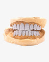 10 on 10 VVS Moissanite Prong Diamond Grillz - White Gold