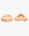 10 on 10 VVS Moissanite Prong Diamond Grillz - Yellow Gold