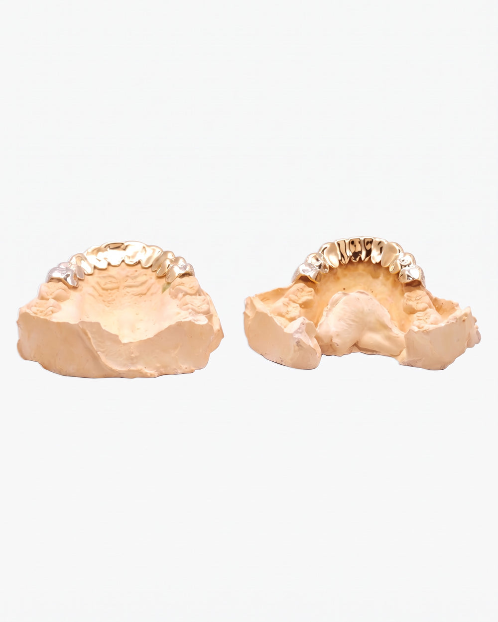 10 on 10 VVS Moissanite Prong Diamond Grillz - Yellow Gold