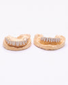 10 on 10 VVS Moissanite Prong Diamond Grillz - Yellow Gold
