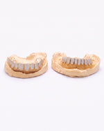 10 on 10 VVS Moissanite Prong Diamond Grillz - Yellow Gold