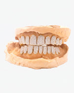 10 on 10 VVS Moissanite Prong Diamond Grillz - Yellow Gold