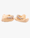 10 on 10 VVS Moissanite Prong Diamond Grillz - Yellow Gold