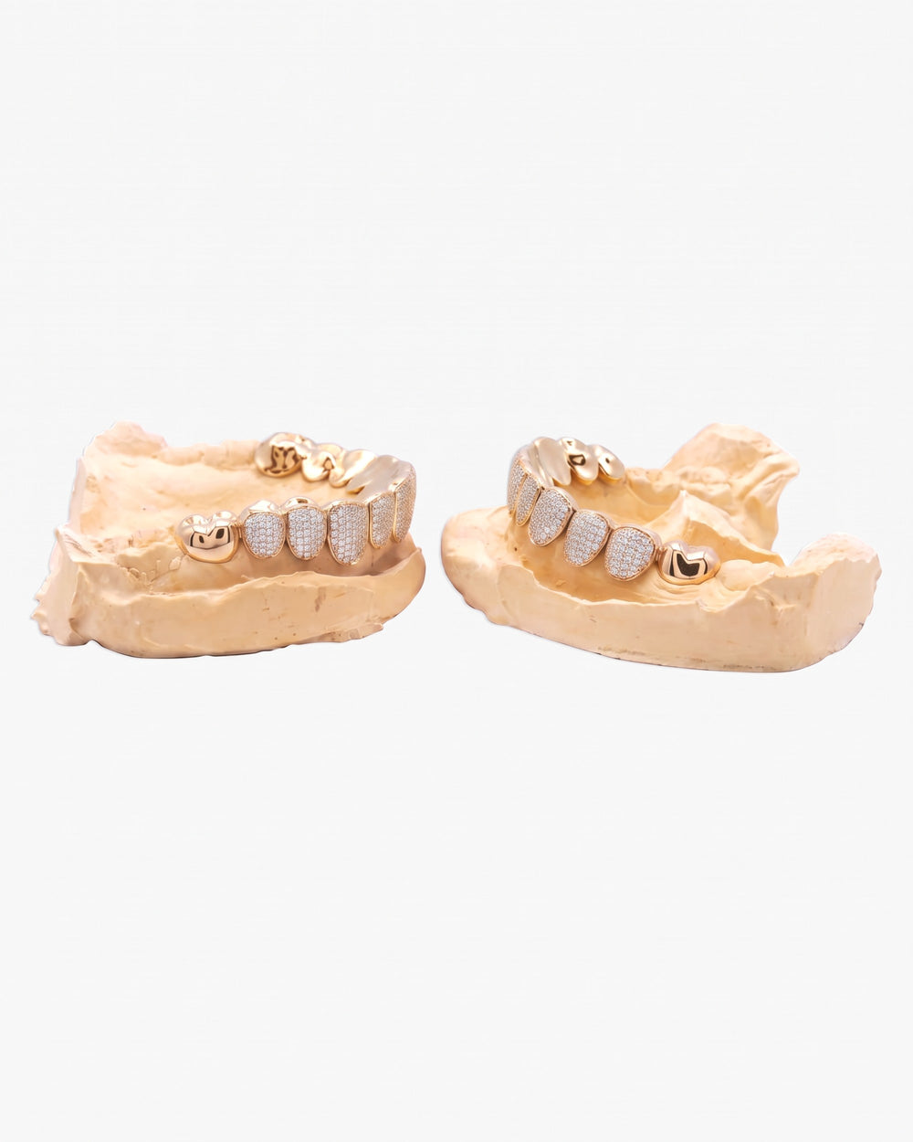 10 on 10 VVS Moissanite Prong Diamond Grillz - Yellow Gold