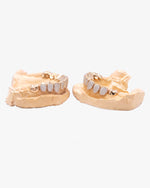 10 on 10 VVS Moissanite Prong Diamond Grillz - Yellow Gold