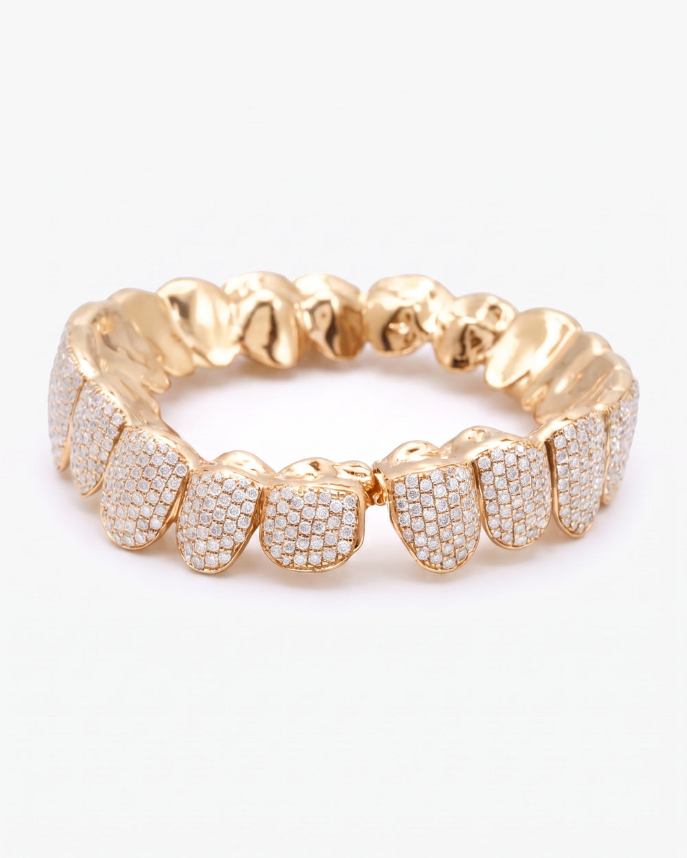 10 on 10 VVS Moissanite Prong Diamond Grillz - Yellow Gold