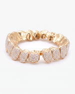 10 on 10 VVS Moissanite Prong Diamond Grillz - Yellow Gold