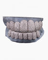 Rose Gold Perm Cut Custom Diamond Grillz 14K Gold - White Gold