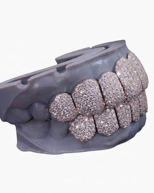 8 on 8 perm cut custom diamond grillz front icecartel px white side