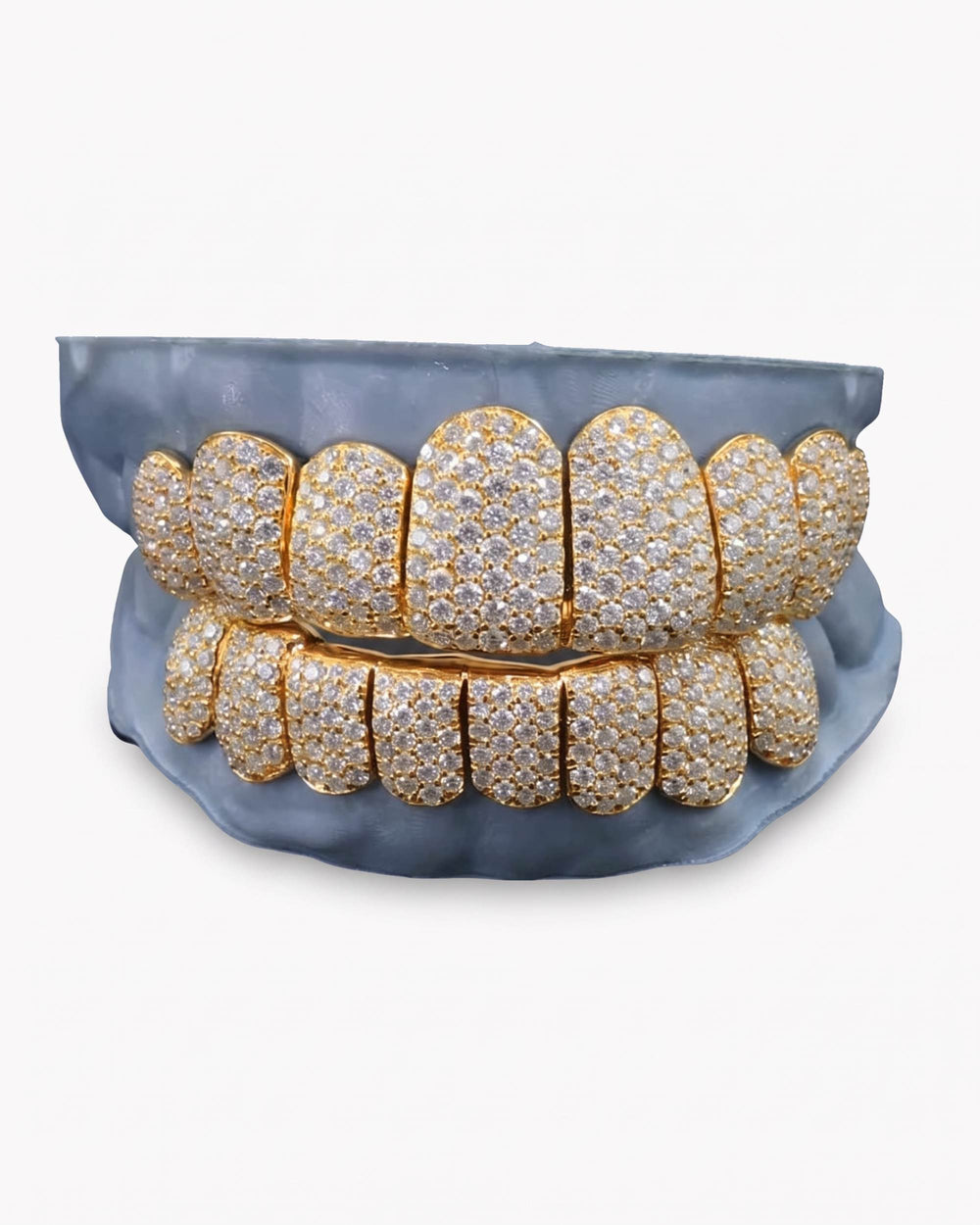 Rose Gold Perm Cut Custom Diamond Grillz 14K Gold - Yellow Gold
