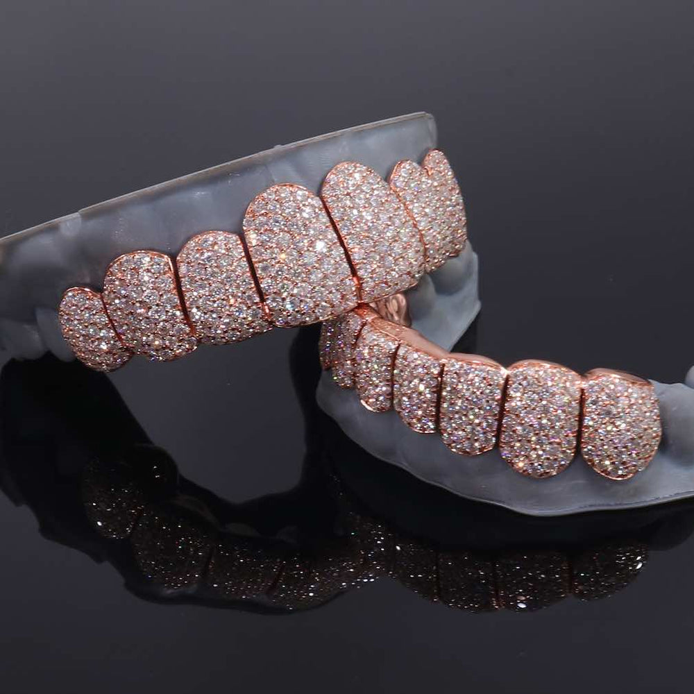 Rose Gold Perm Cut Custom Diamond Grillz detailed