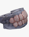 Rose Gold Perm Cut Custom Diamond Grillz 14K Gold - Rose Gold