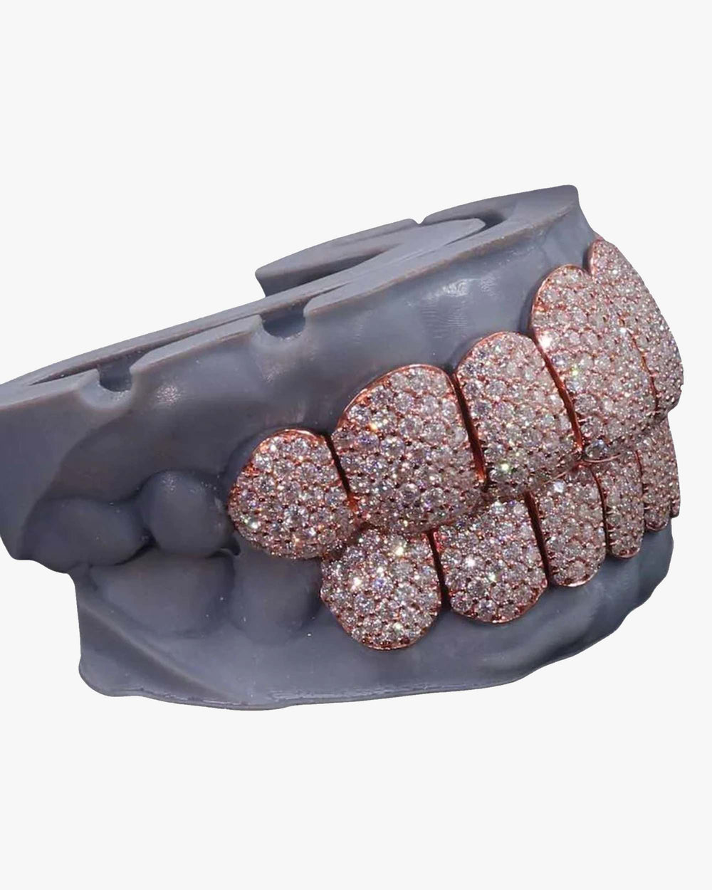 8 on 8 perm cut custom diamond grillz rose gold front icecartel px side