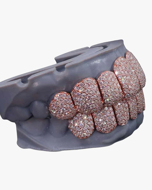 8 on 8 perm cut custom diamond grillz rose gold front icecartel px side