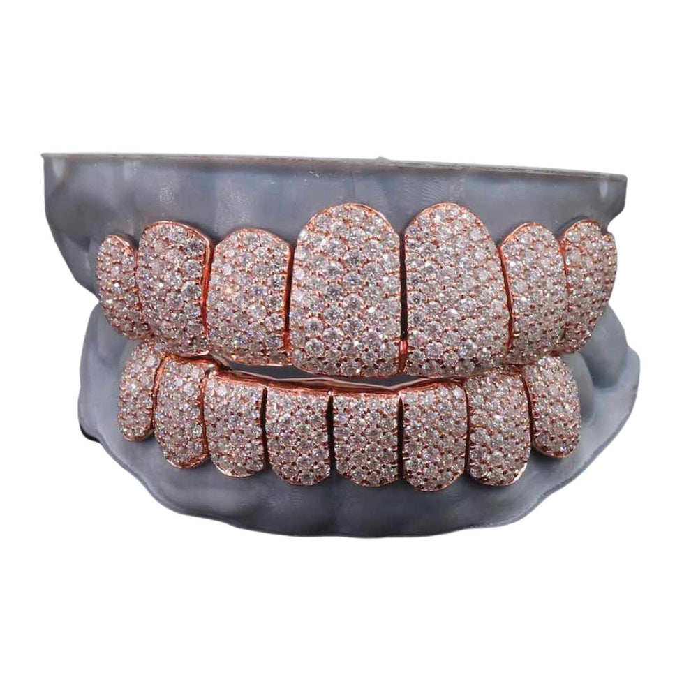 Rose Gold Perm Cut Custom Diamond Grillz front icecartel