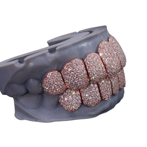 Rose Gold Perm Cut Custom Diamond Grillz side icecartel