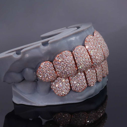 Rose Gold Perm Cut Custom Diamond Grillz side