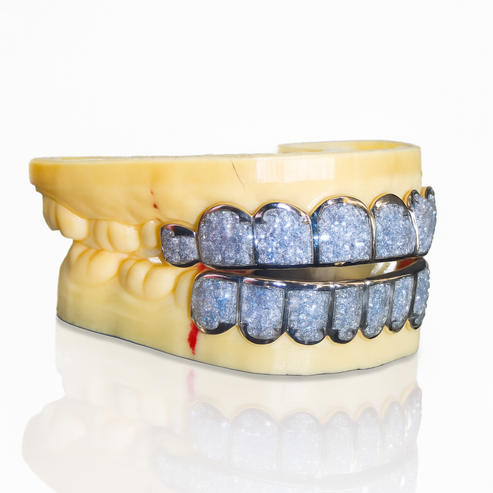 moissanite baguette diamond grillz side 1