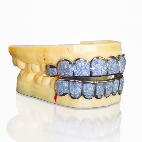 moissanite baguette diamond grillz side 1