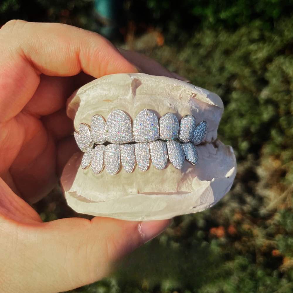 Custom Grillz That Match Your Style