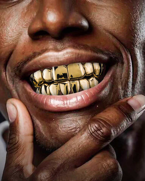 Gold moissanite grillz model icecartel px