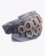 Rose Gold Open Face Custom Diamond Grillz - White Gold