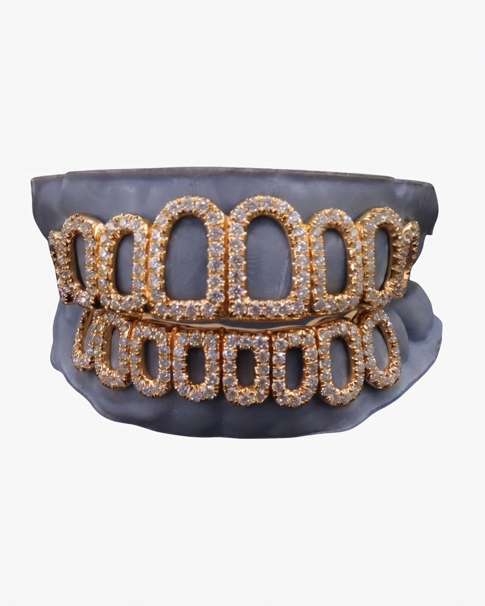 Rose Gold Open Face Custom Diamond Grillz - Yellow Gold