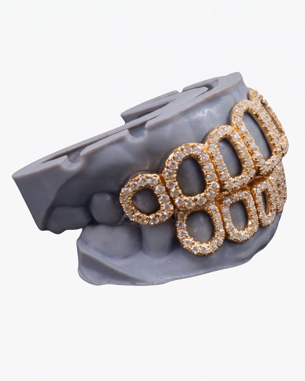 Rose Gold Open Face Custom Diamond Grillz - Yellow Gold