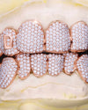 Custom Letter Moissanite Grillz - Rose Gold