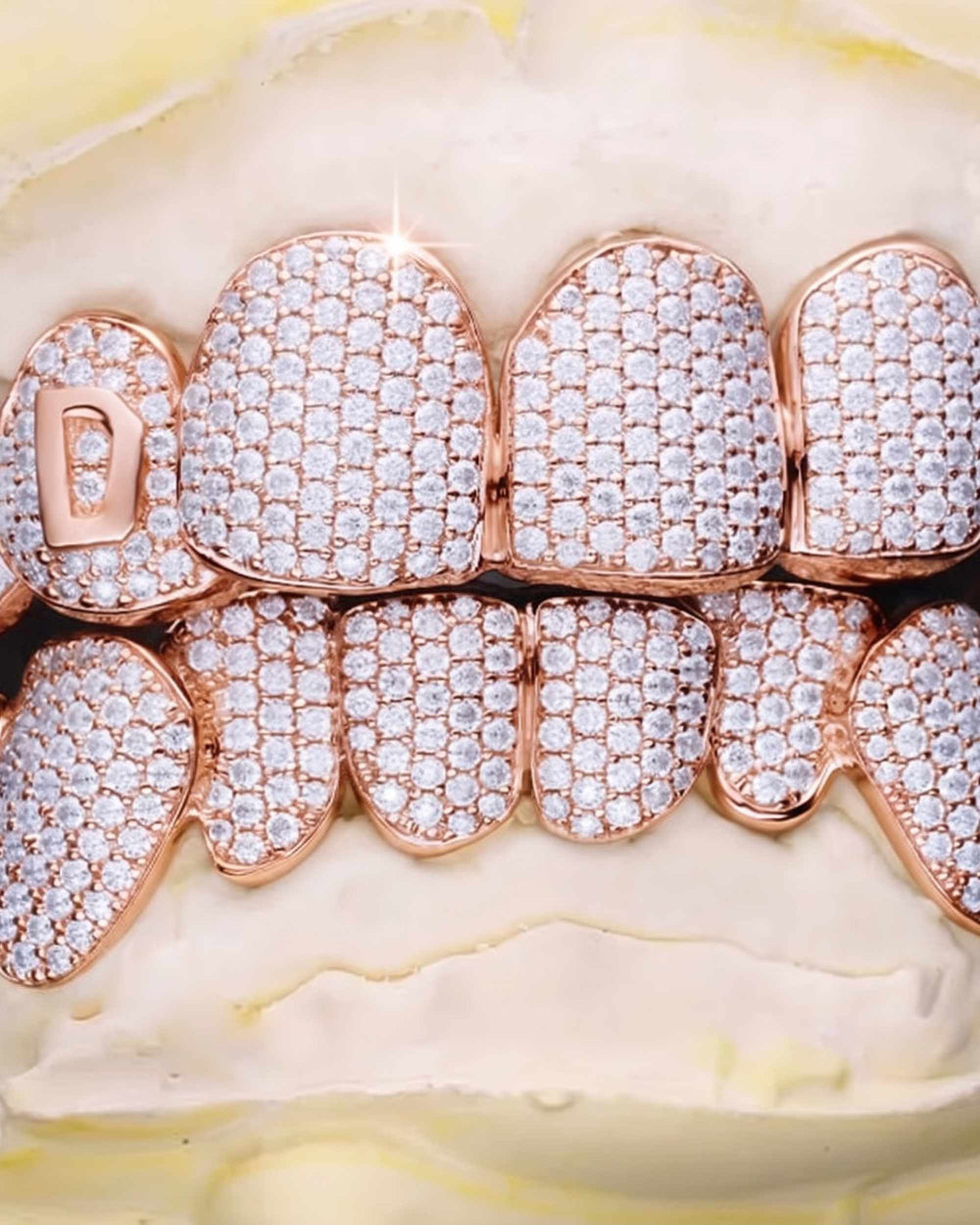 Custom Letter Moissanite Grillz - Rose Gold