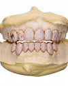 Custom Letter Moissanite Grillz - Rose Gold