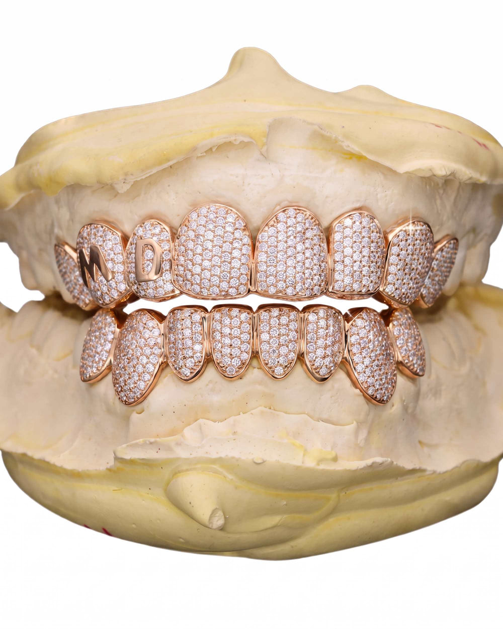 Custom Letter Moissanite Grillz - Rose Gold