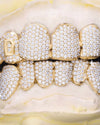 Custom Letter Moissanite Grillz - Yellow Gold